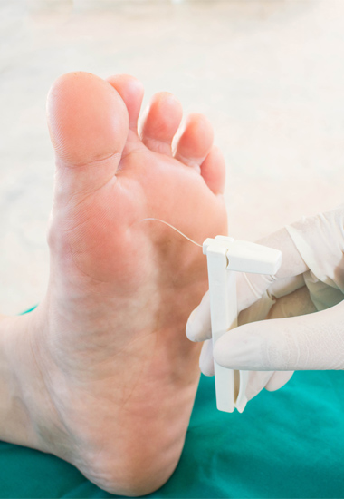 Mobile podiatrist in Falkirk and Scotland diabetic footcare nervous system and numbness test