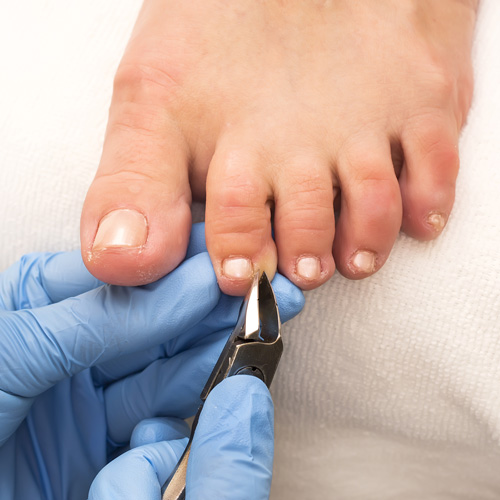 Mobile podiatrist in Falkirk and Scotland podiatrist clipping toenails